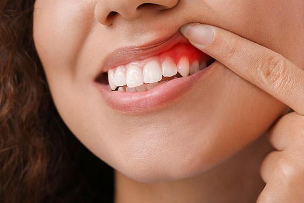 When It Is Time To Seek Professional Gum Disease Treatment